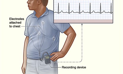 Pruebas Diagnósticas